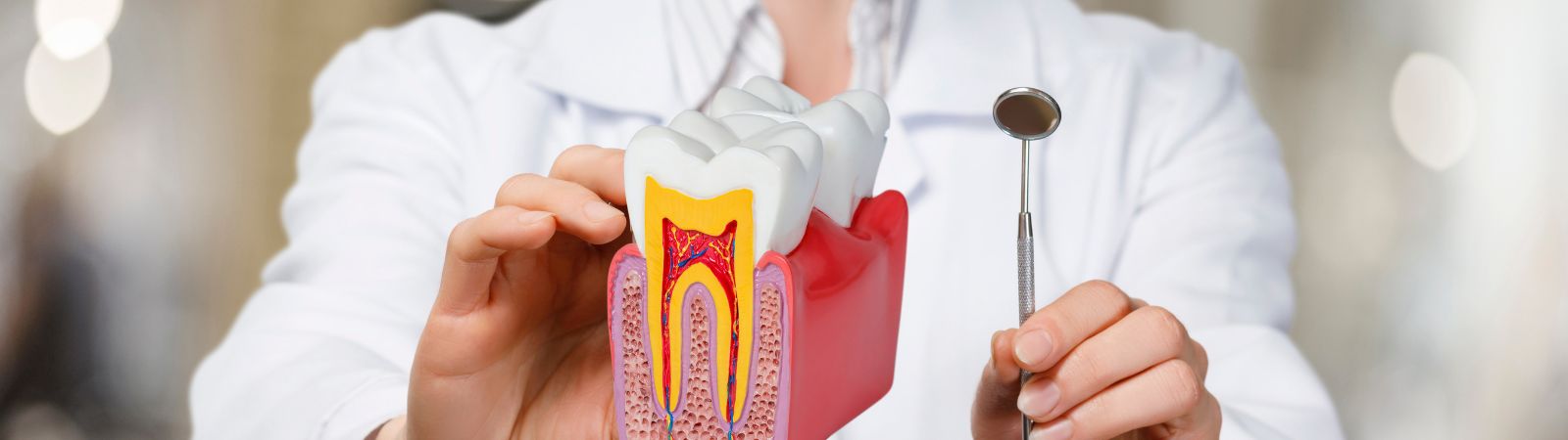 Root Canal Treatment