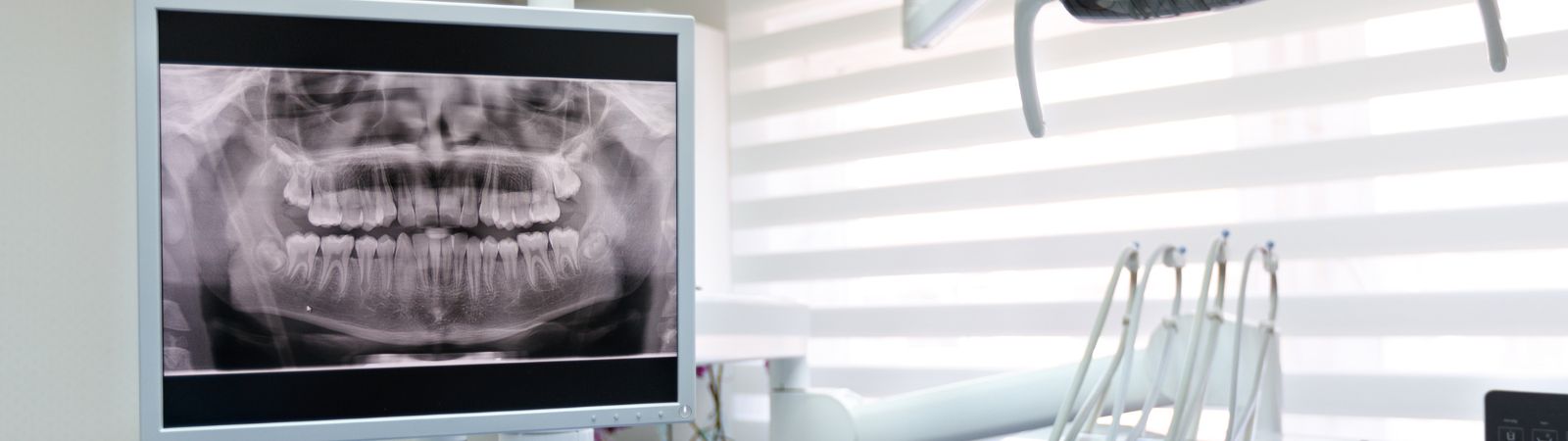 Dental X-Rays